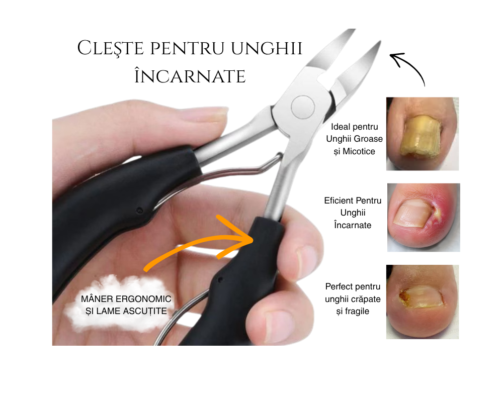Cleste unghii incarnate